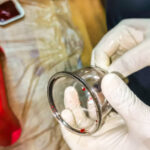 cupping or hijama therapist is preparing cup for upping therapy